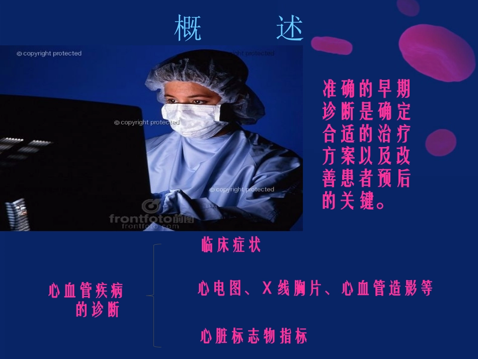 心脏标志物.新讲解.徐.ppt_第3页
