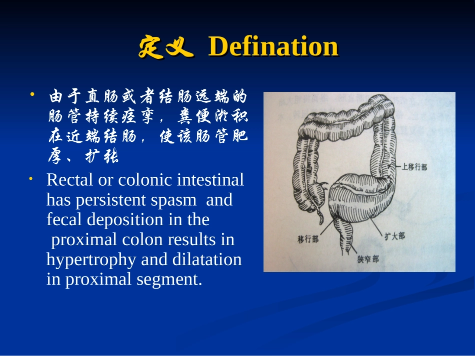 先天性巨结肠与胆道剖析.ppt_第2页