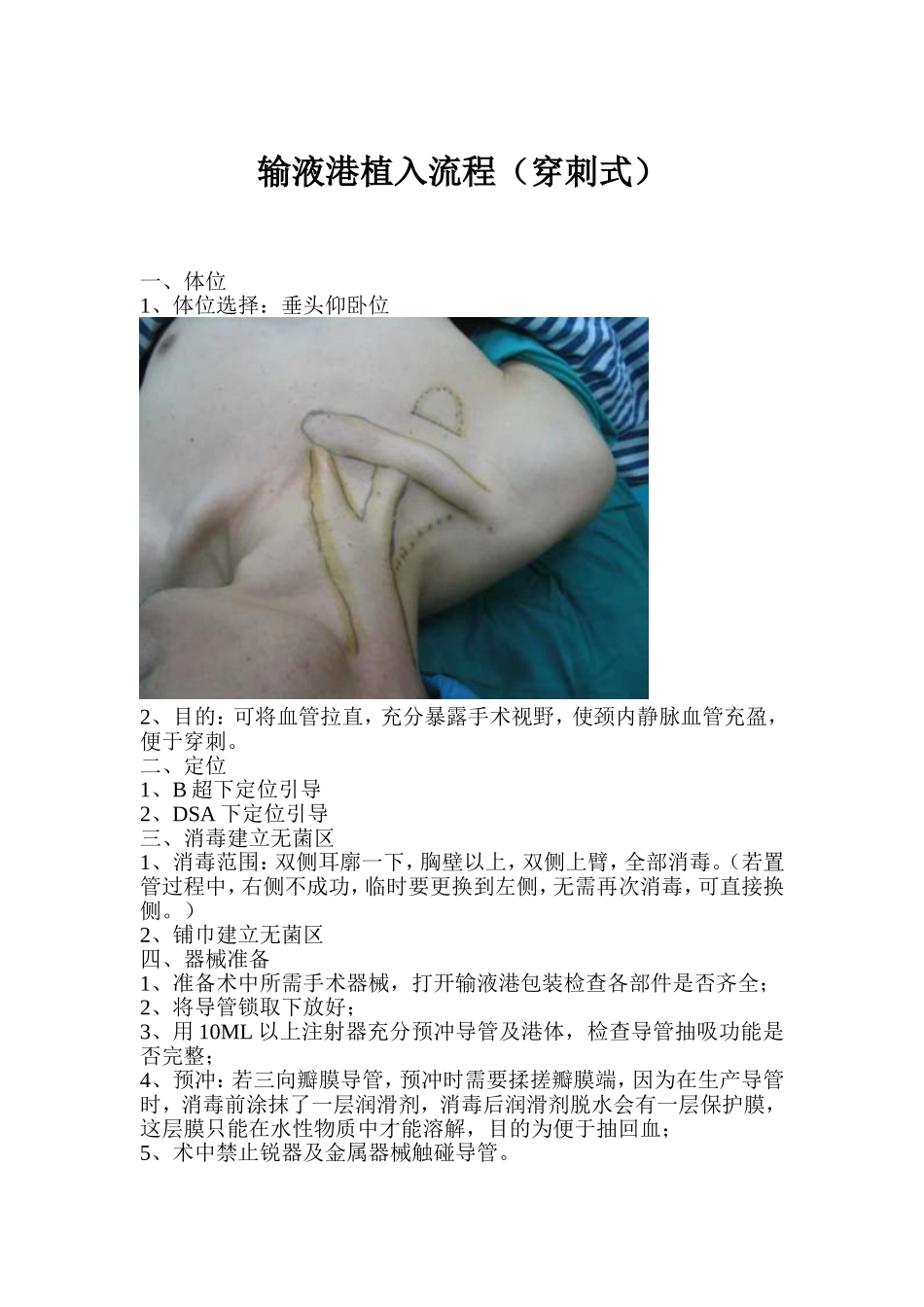 植入式静脉输液港植入流程穿刺法.doc_第1页