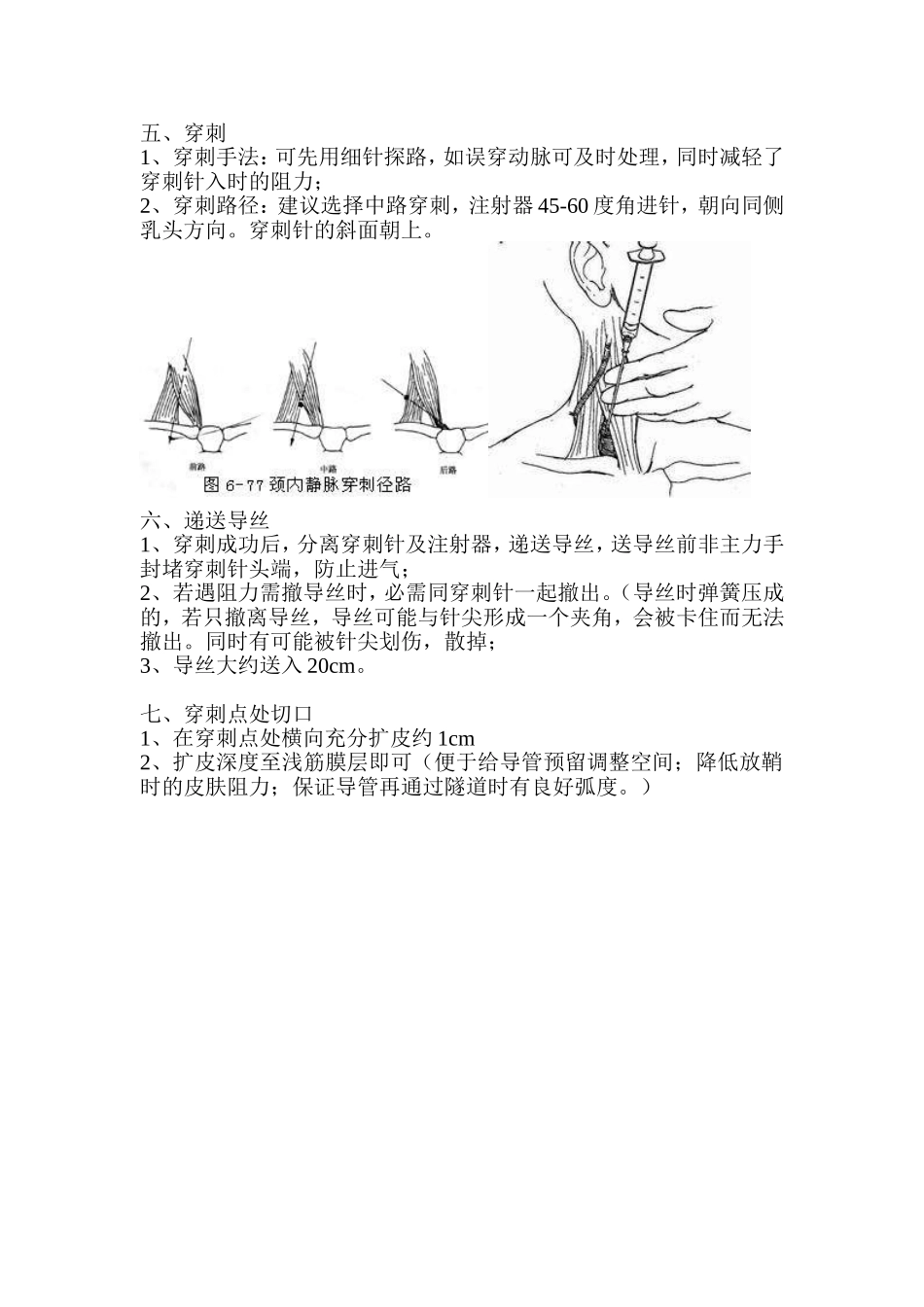 植入式静脉输液港植入流程穿刺法.doc_第2页