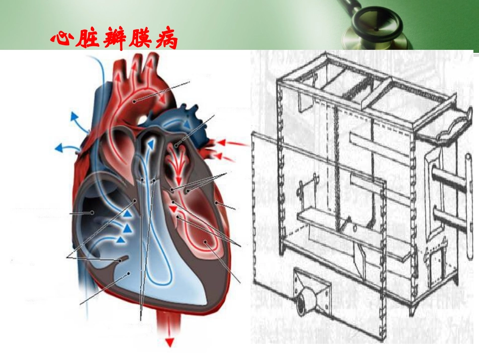 心脏瓣膜病郭武.ppt_第2页
