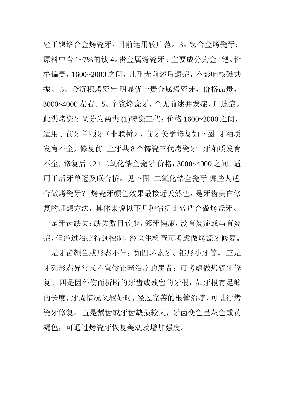 常用几种烤瓷牙的优缺点.doc_第2页