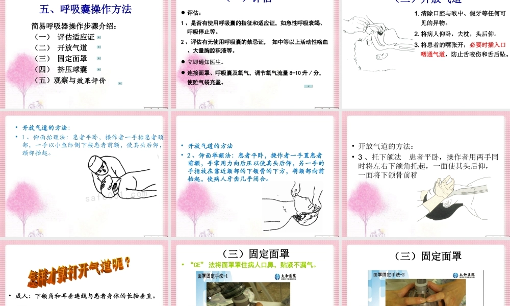 呼吸囊的使用.ppt