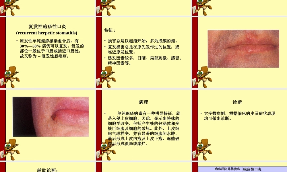 口腔单纯疱疹.ppt