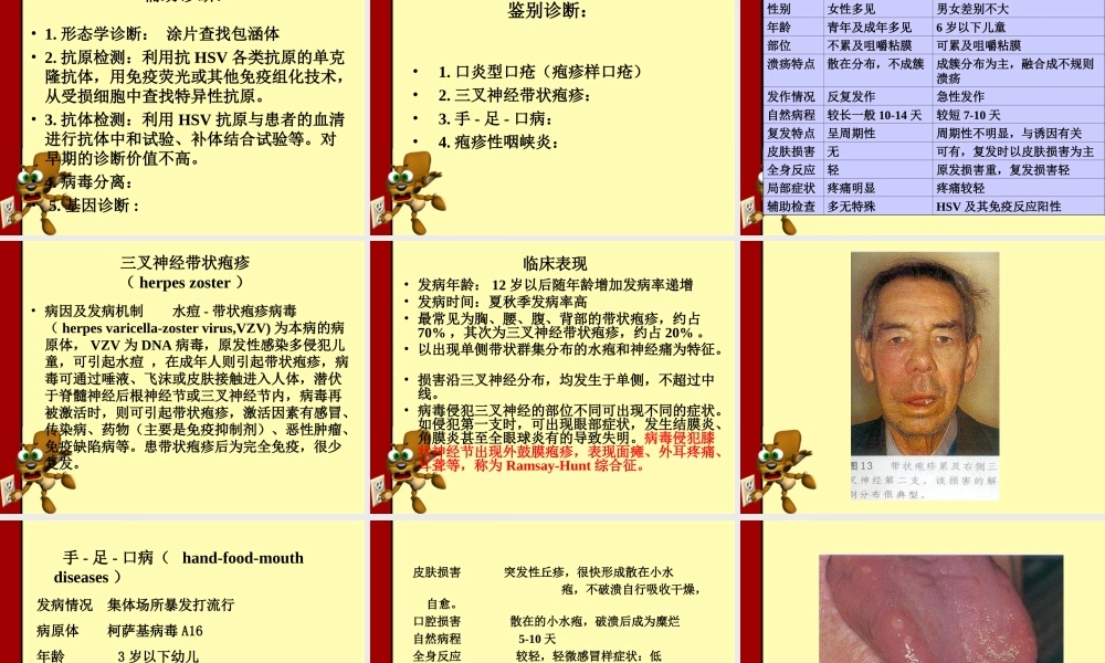 口腔单纯疱疹.ppt
