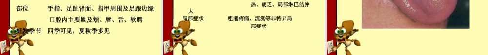 口腔单纯疱疹.ppt