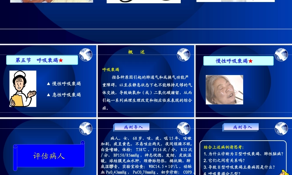 呼吸衰竭-2-5.ppt