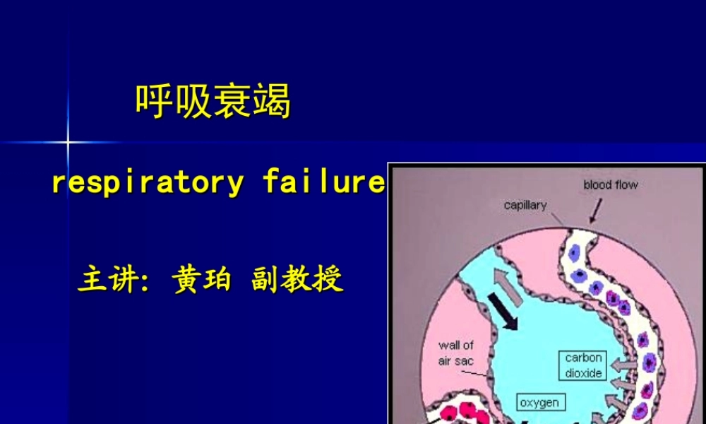 呼吸衰竭、ARDS.ppt