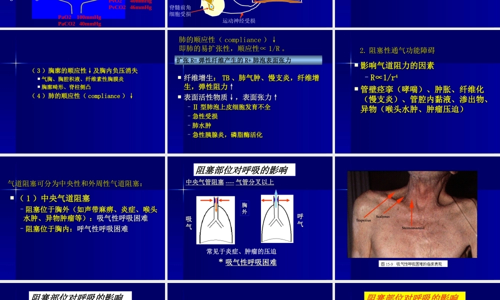 呼吸衰竭、ARDS.ppt