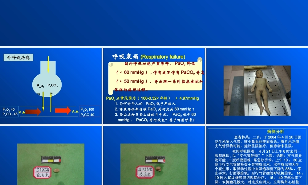 呼吸功能不全.ppt