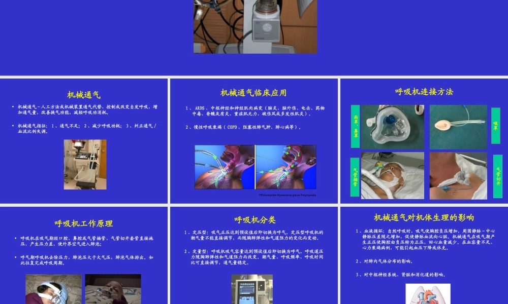 呼吸机参数调节和监测.ppt