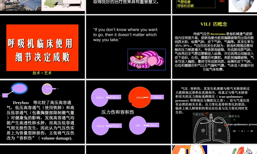 呼吸机并发症.ppt