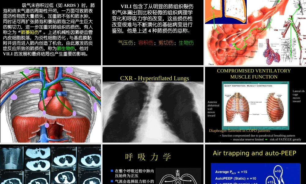 呼吸机并发症.ppt
