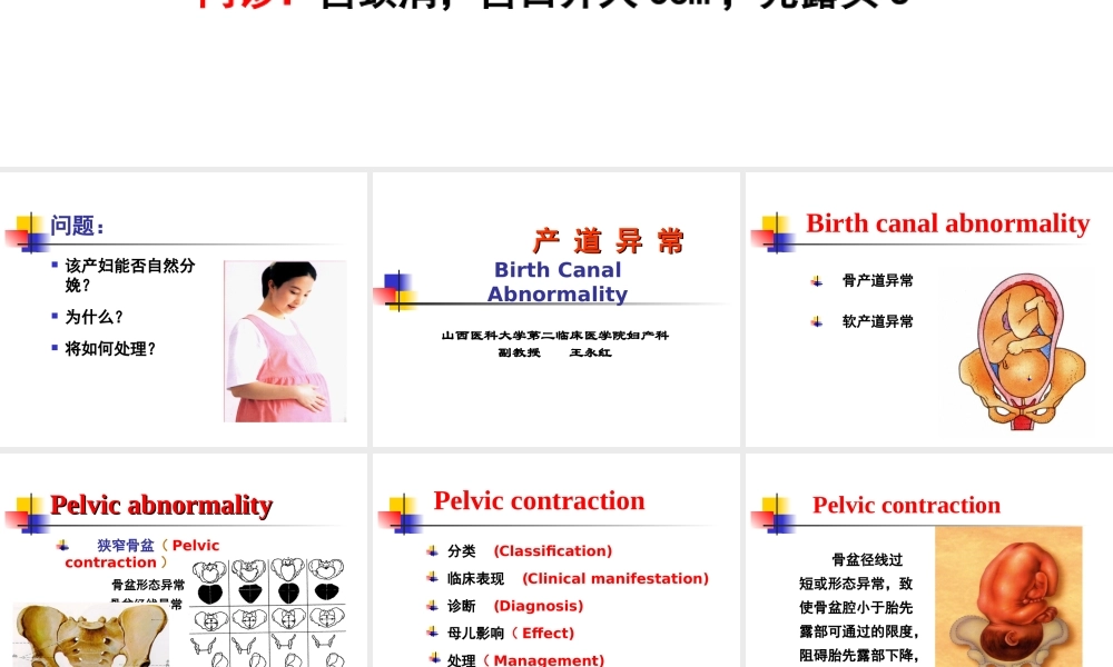 坐骨棘间径8cm.ppt