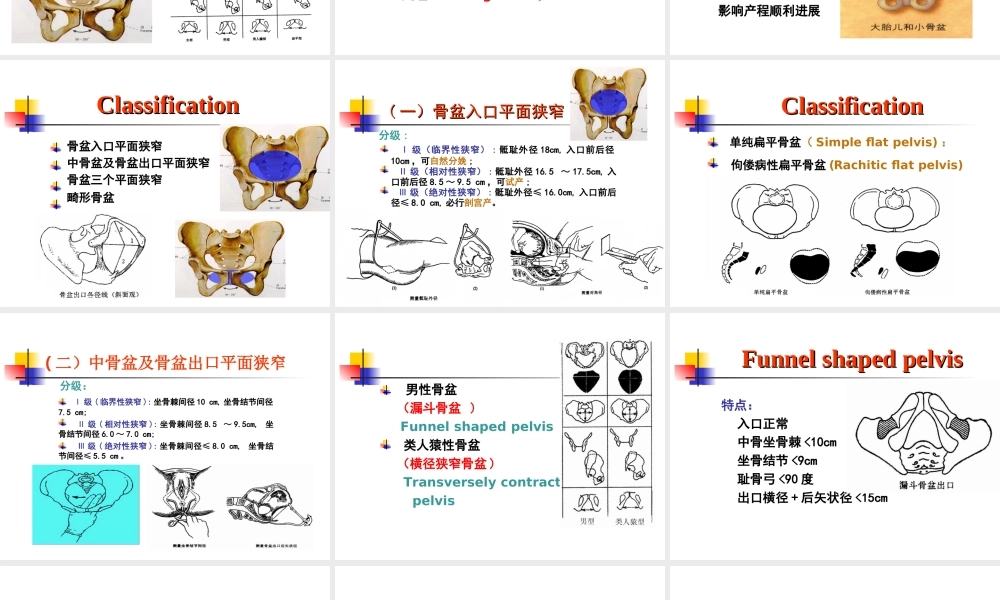 坐骨棘间径8cm.ppt