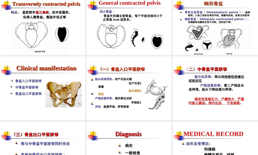 坐骨棘间径8cm.ppt