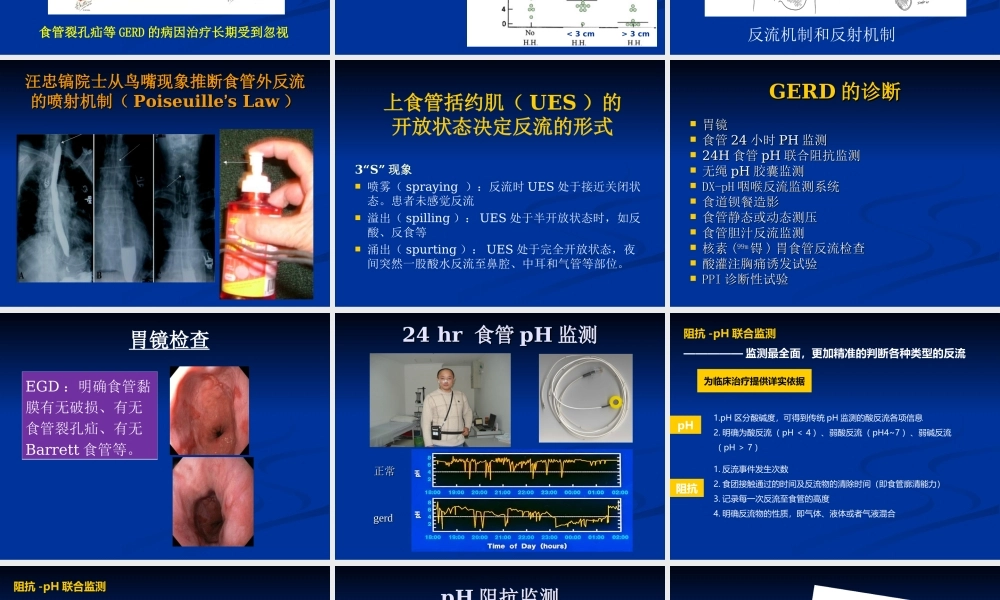 国内胃食管反流病诊疗现状和进展...吴继敏.ppt