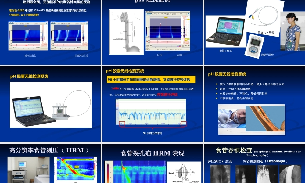 国内胃食管反流病诊疗现状和进展...吴继敏.ppt