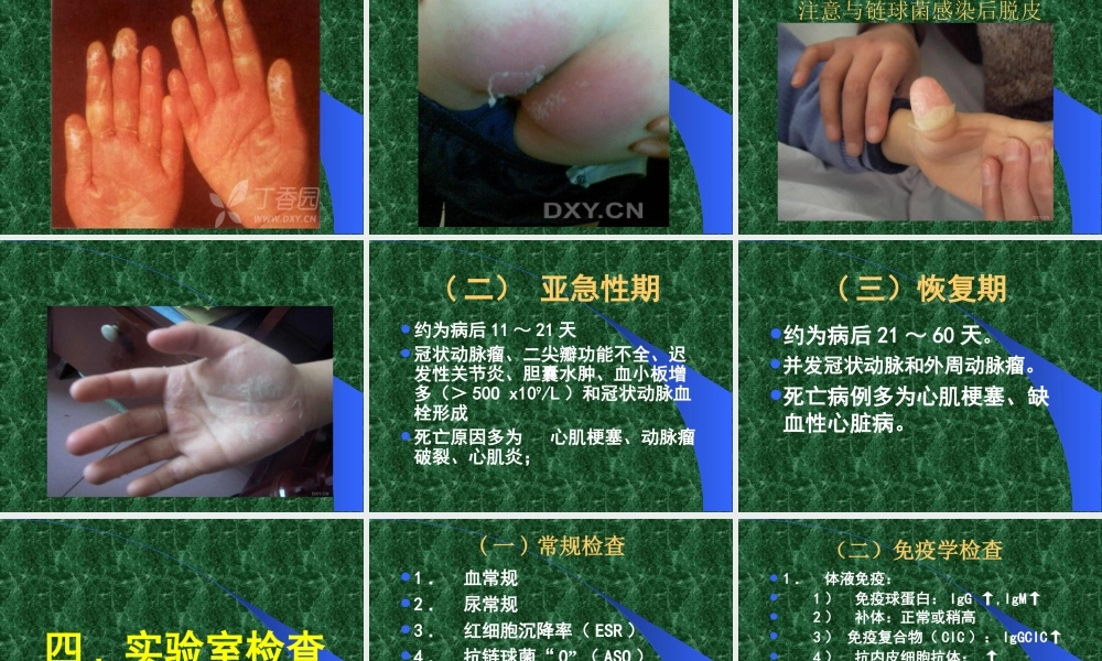 川崎病的诊治.ppt