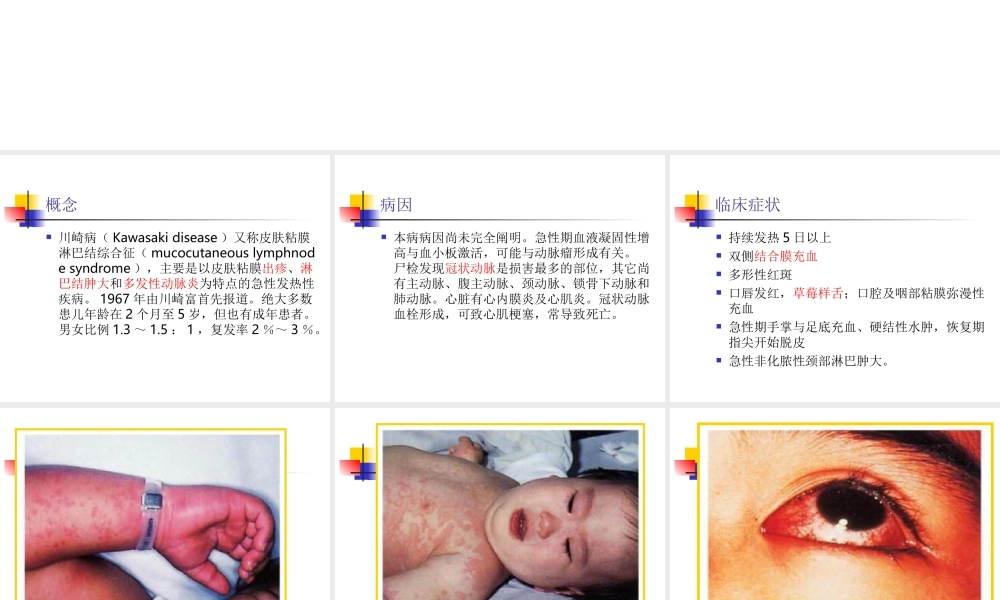 川崎病教学查房新.ppt