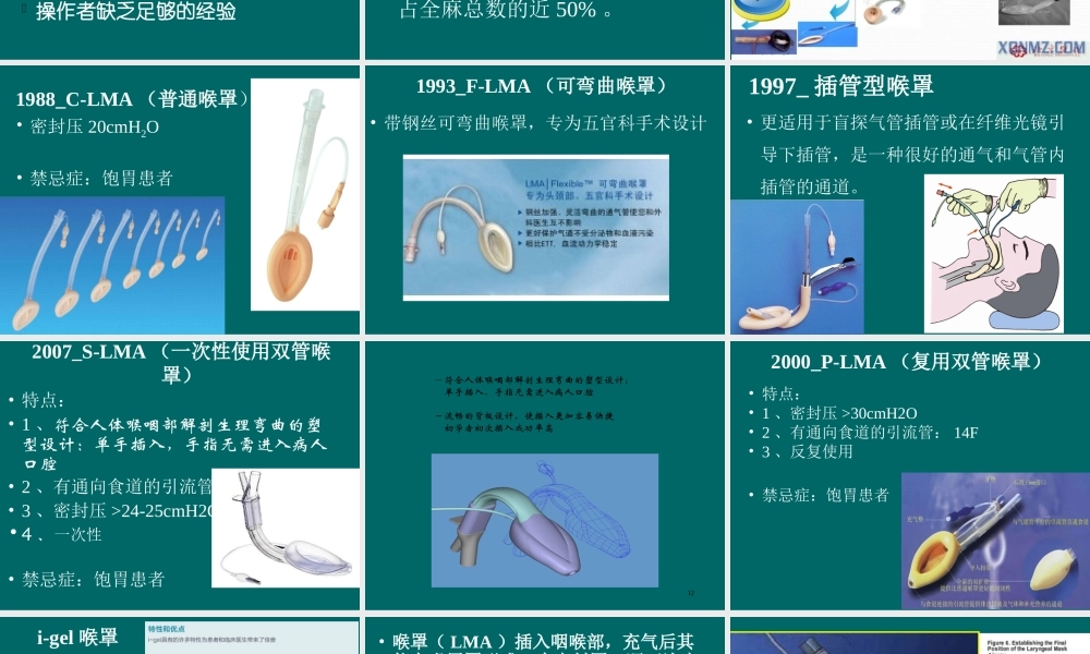 喉罩的使用资料.ppt