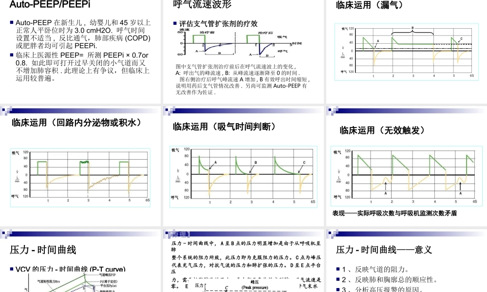 基础呼吸机波形分析、SIMV模式-丁广湘.ppt