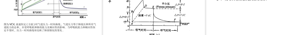 基础呼吸机波形分析、SIMV模式-丁广湘.ppt