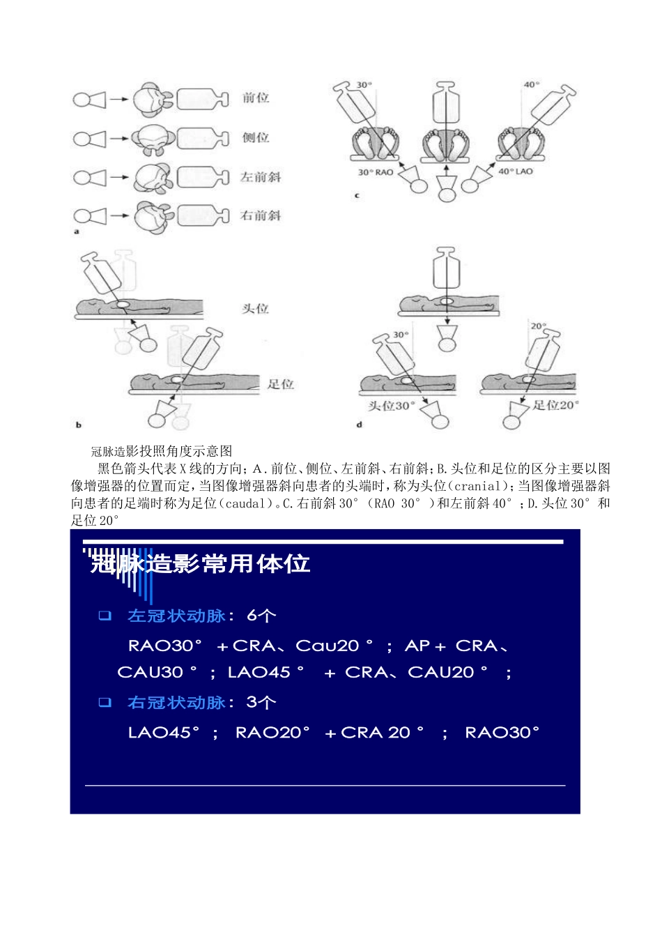 冠状动脉造影体位图片.doc_第2页