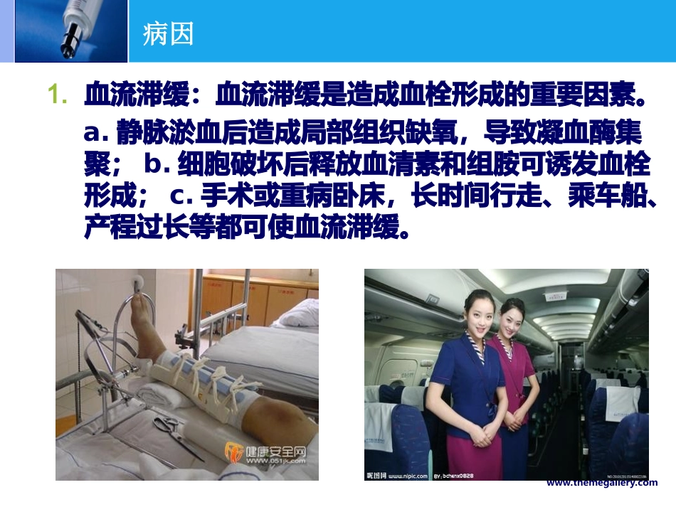 下肢深静脉血栓PPT.ppt_第3页