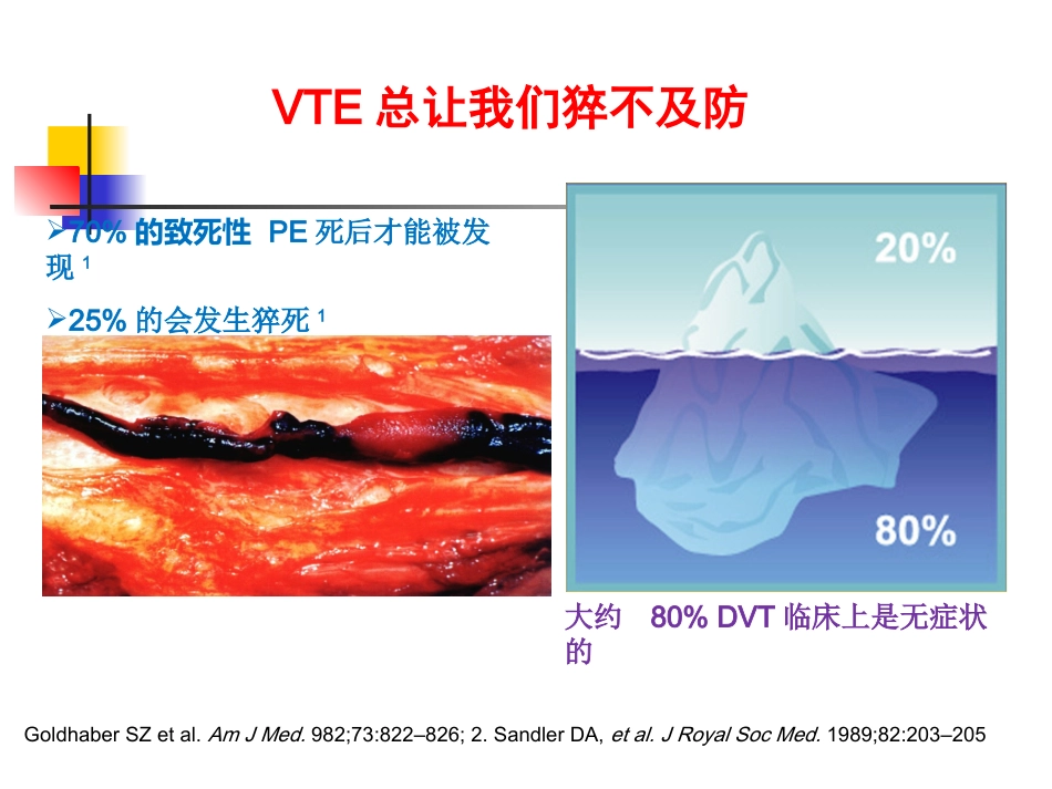 下肢深静脉血栓讲课.ppt_第3页