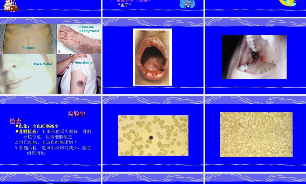 3再生障碍性贫血.ppt