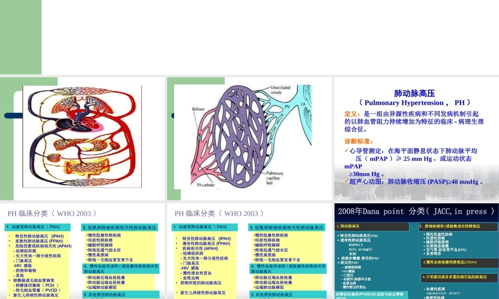 CTD-肺动脉高压概述.ppt