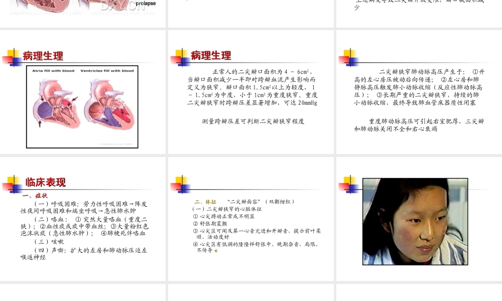 5.第三篇-第八章-心脏瓣膜病.ppt