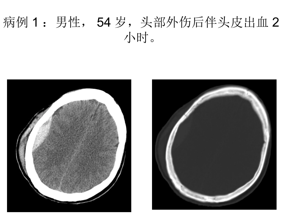头颈部外伤病例常见病、多发病.ppt_第2页