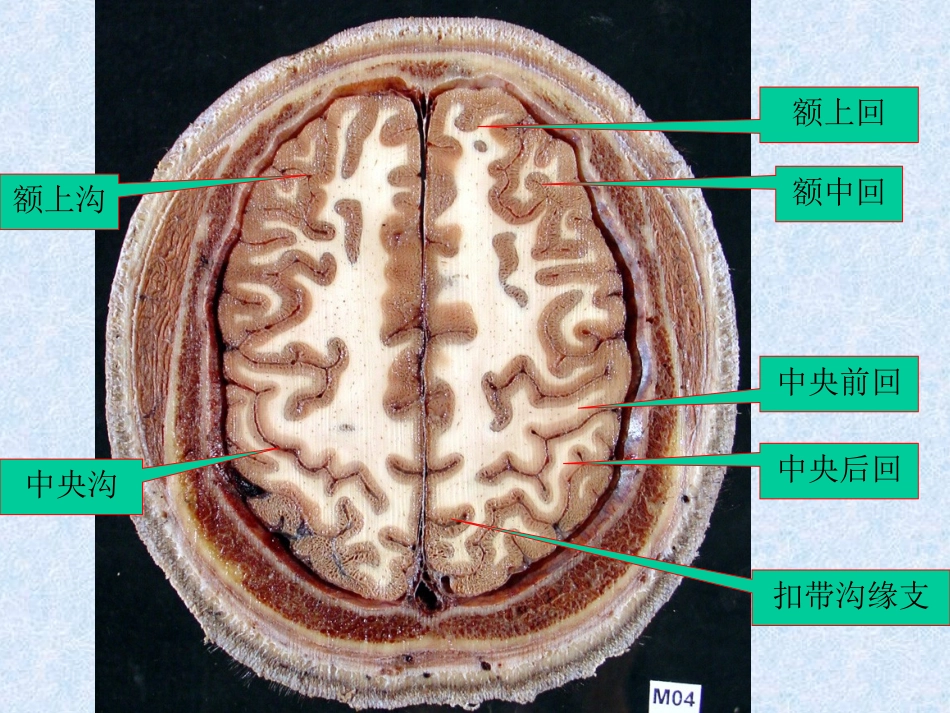 头颈部—fy.ppt_第3页