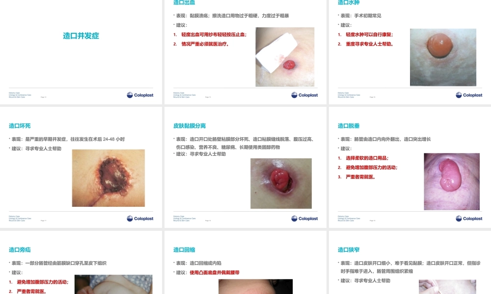 3造口并发症介绍.pptx