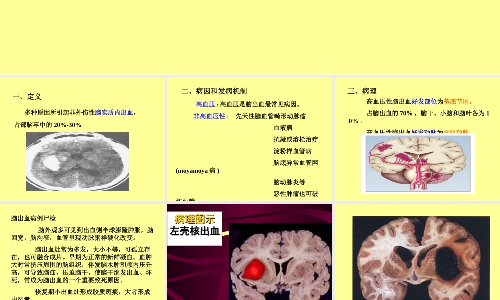 7.脑出血.ppt