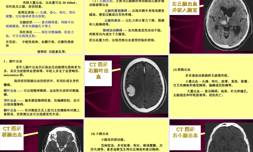 7.脑出血.ppt