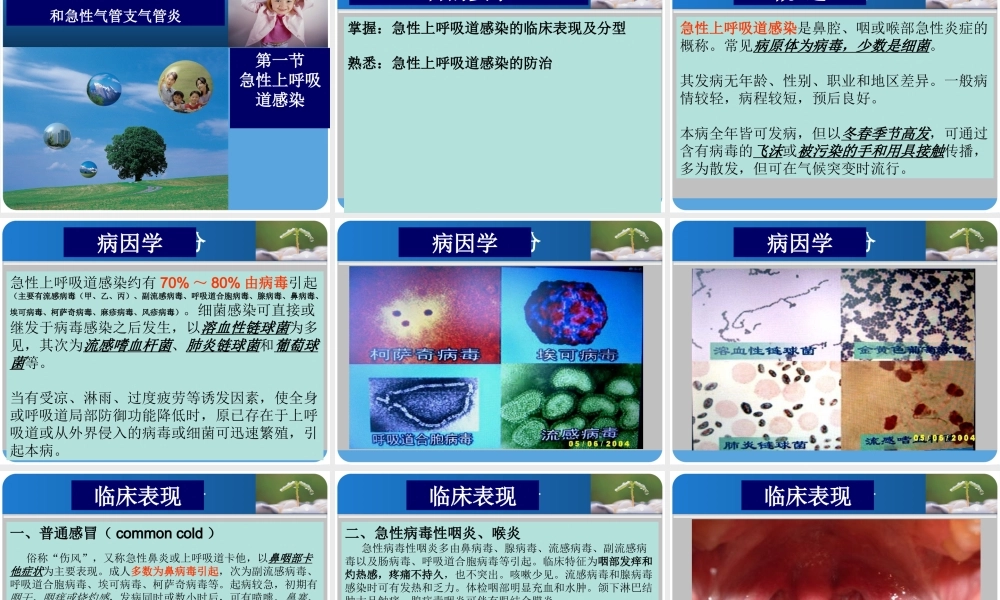 9.13急性上呼吸道感染.ppt