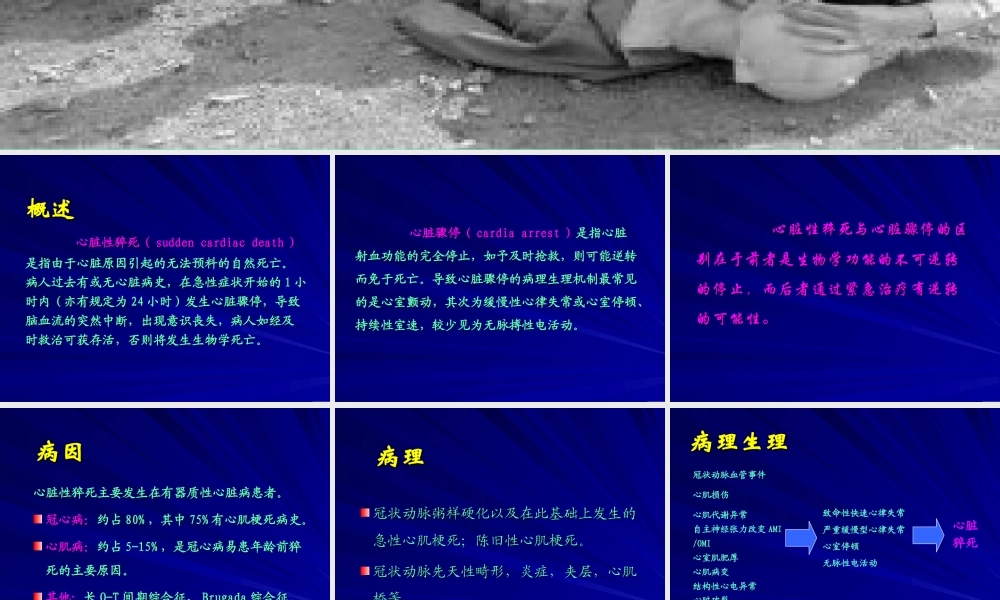 3心脏骤停与心肺复苏.ppt