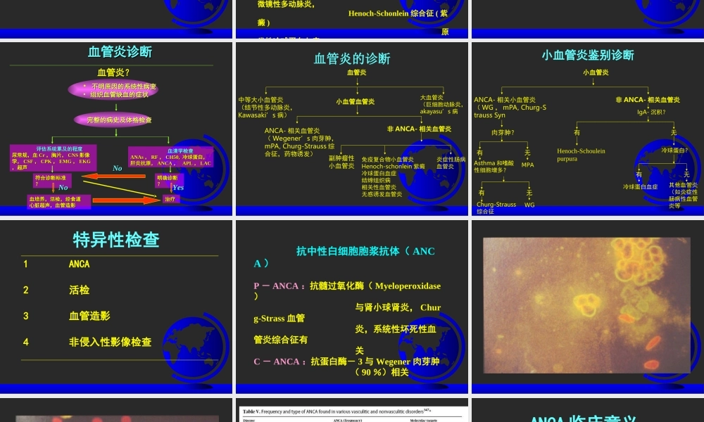 ANCA相关性血管炎.ppt