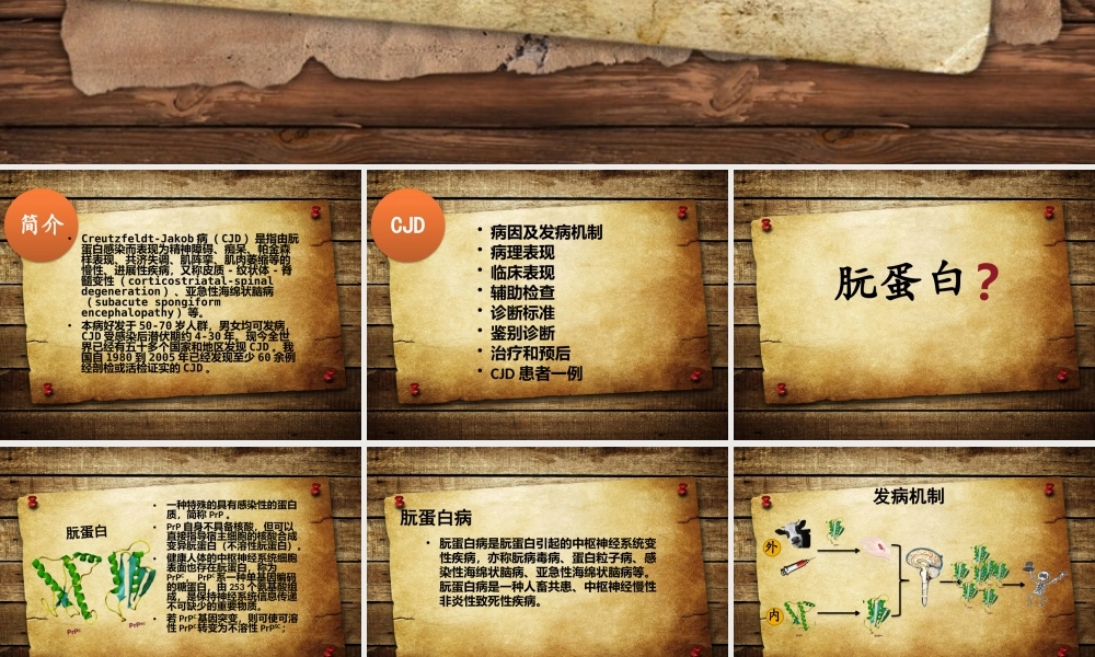 CJD介绍及病例.ppt