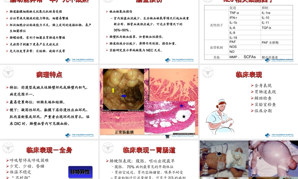 NEC(新生儿坏死性小肠结肠炎).ppt