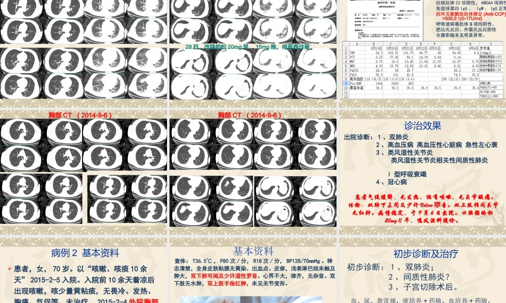 CTD-ILD(肺科20151007).ppt