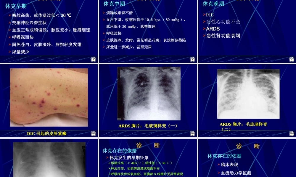 CP感染性休克.ppt