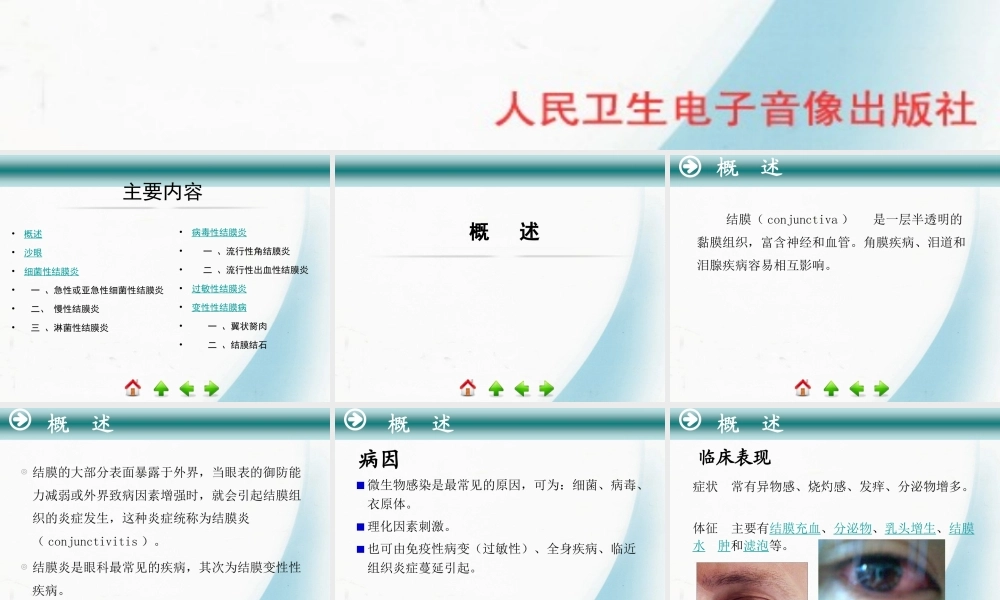 5第五节-结膜病.ppt