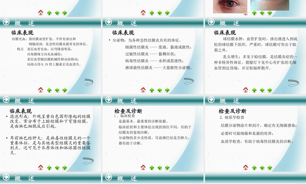 5第五节-结膜病.ppt