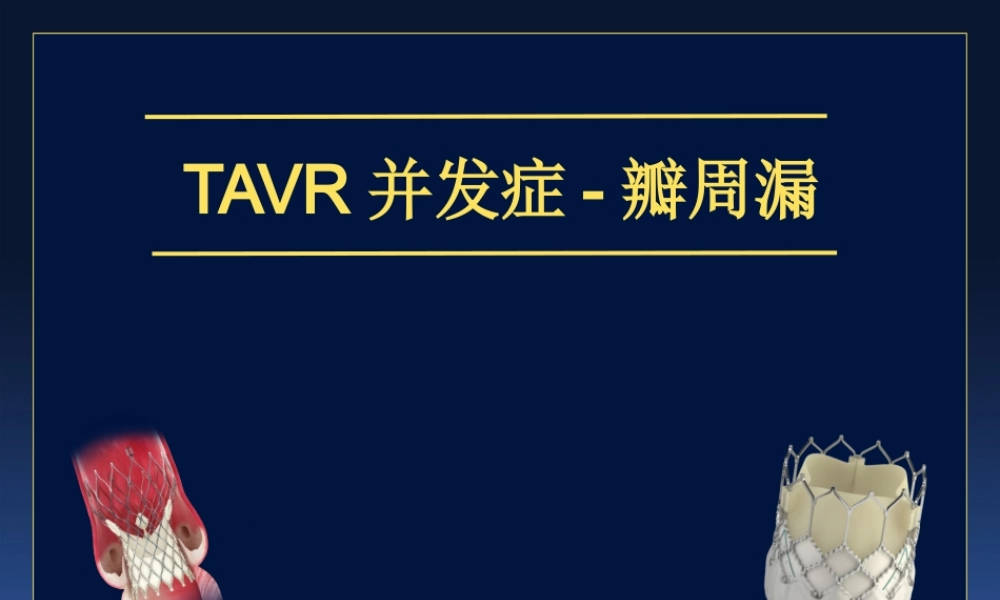 TAVR并发症-瓣周漏.ppt