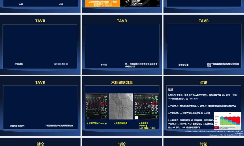 TAVR并发症-瓣周漏.ppt