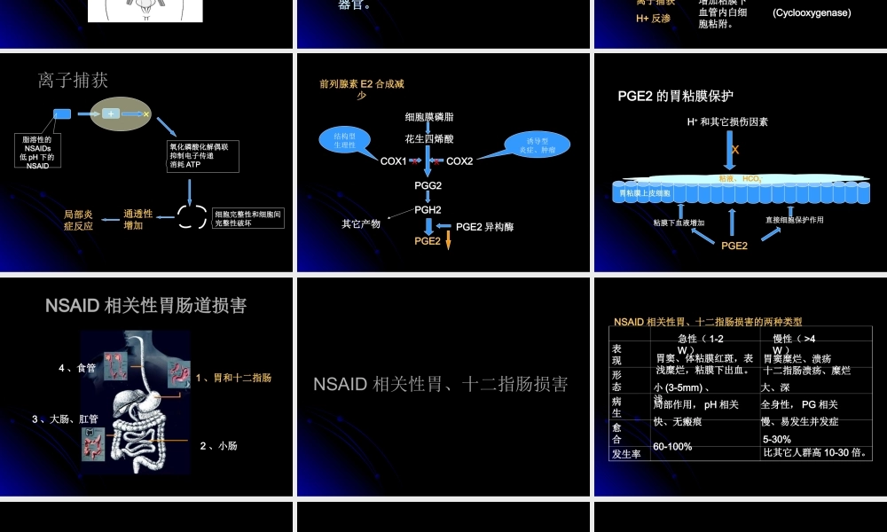 NSaid性胃肠道损害.ppt